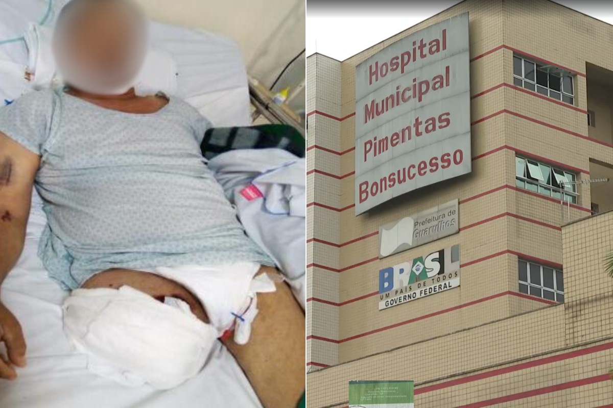 Pedreiro tem perna amputada e morre por negligência médica; prefeitura é condenada a pagar R$ 300 mil à viúva