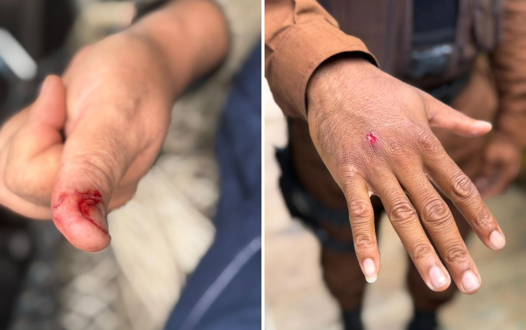 Macaco-prego invade casas em condomínio na BA, ingere álcool e medicamentos, e deixa feridos após ataque