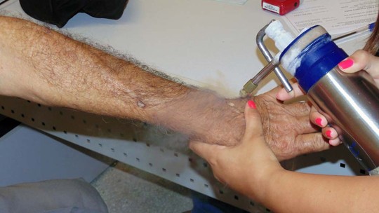 Dezembro Laranja: Liga oferece mil atendimentos dermatológicos gratuitos neste sábado (2) em Natal - Foto: (Hospital Regional/Divulgação)