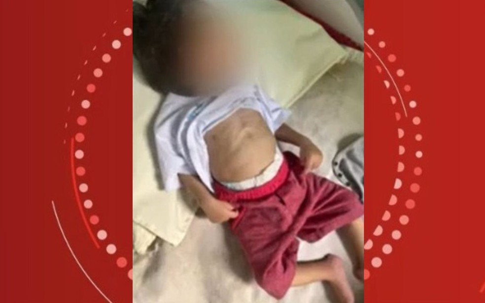 Bebê de 1 ano morre ao dar entrada em hospital na Bahia com desnutrição e marcas de agressão — Foto: Reprodução/TV Sudoeste