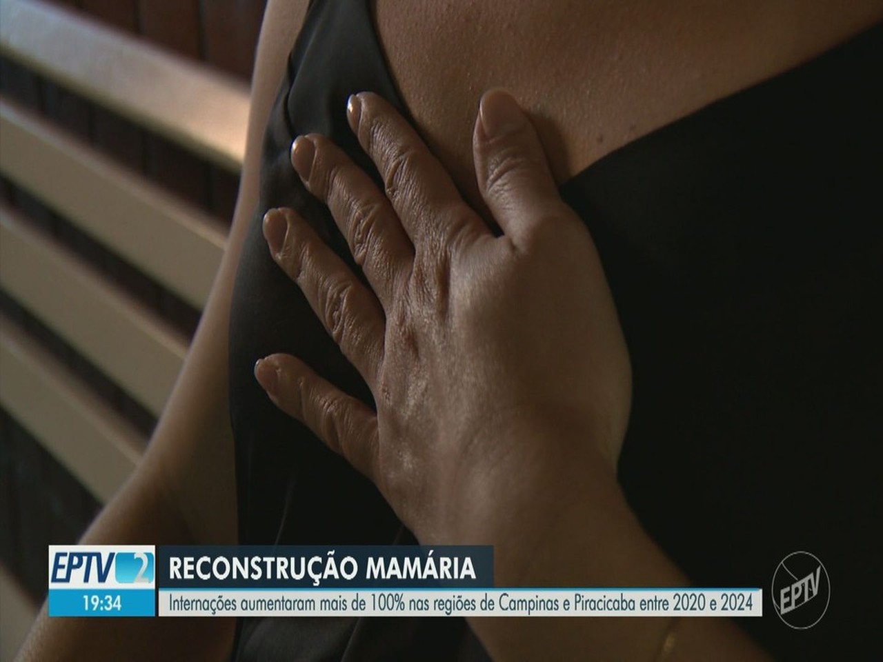 'Era o que eu mais sonhava': número de cirurgias para reconstrução das mamas cresce na região de Campinas