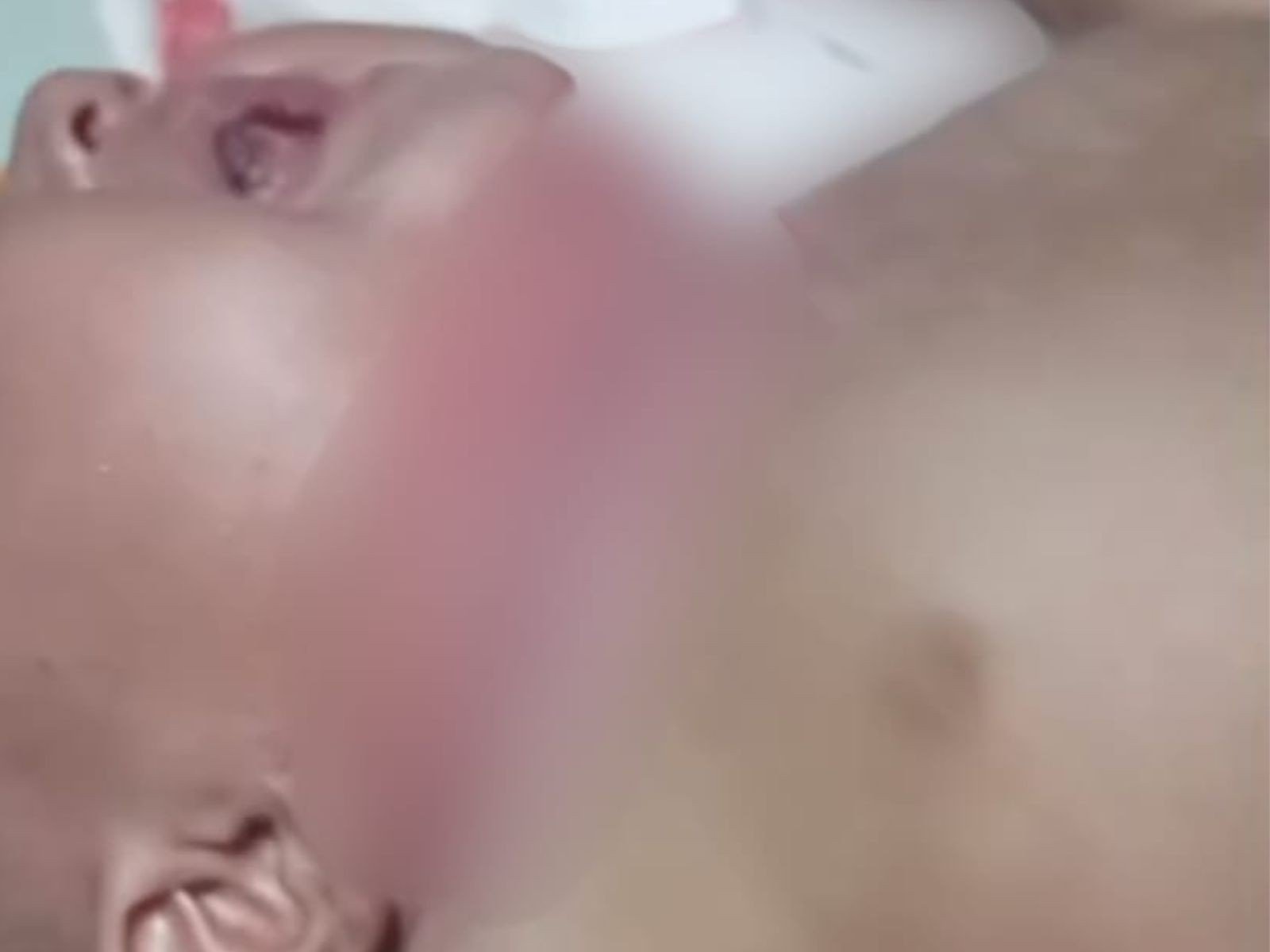 Bebê de 7 meses é internada em estado grave com ferimentos no pescoço e mãe é denunciada por maus-tratos