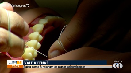 Saiba quais são as vantagens e desvantagens dos planos odontológicos