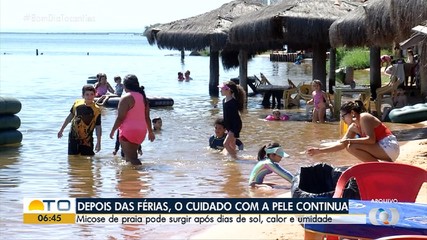 Saiba como identificar e prevenir micoses em temporada de praia