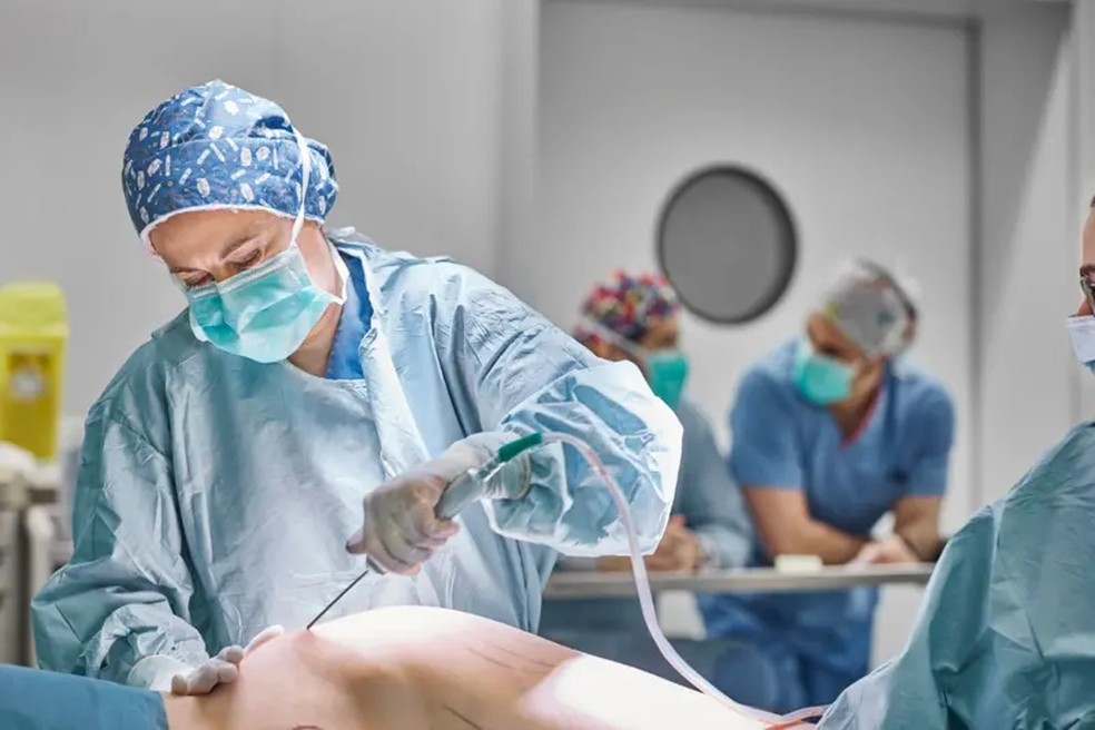 Lipoaspiração pode ser indicada como tratamento em alguns casos — Foto: Crédito: Getty Images
