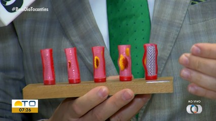 Casos de infarto em jovens acende alerta para cuidados com a saúde do coração