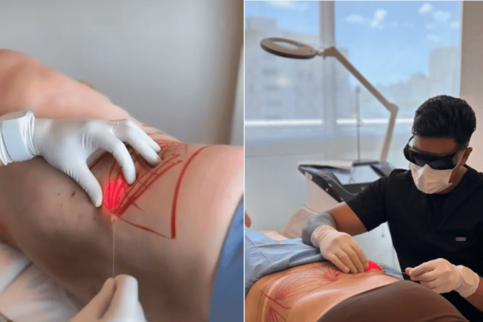 'Me sinto lesada', diz mulher que pagou R$ 2 mil por procedimento estético com falso médico preso em SP