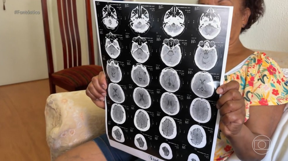 'Golpe dos exames' engana pacientes e rouba dados bancários — Foto: Reprodução/TV Globo