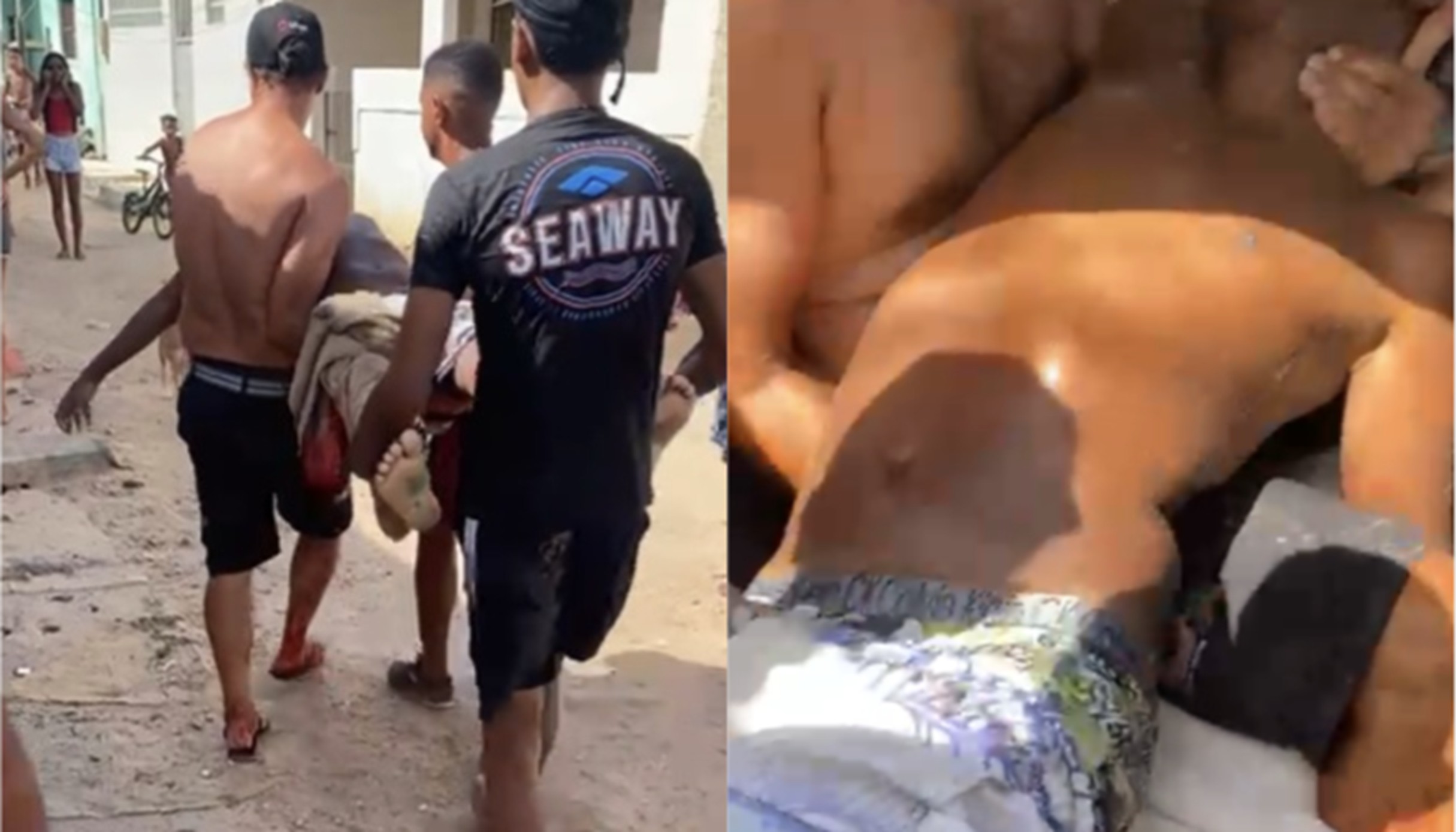 Adolescente é mordido por tubarão em Olinda