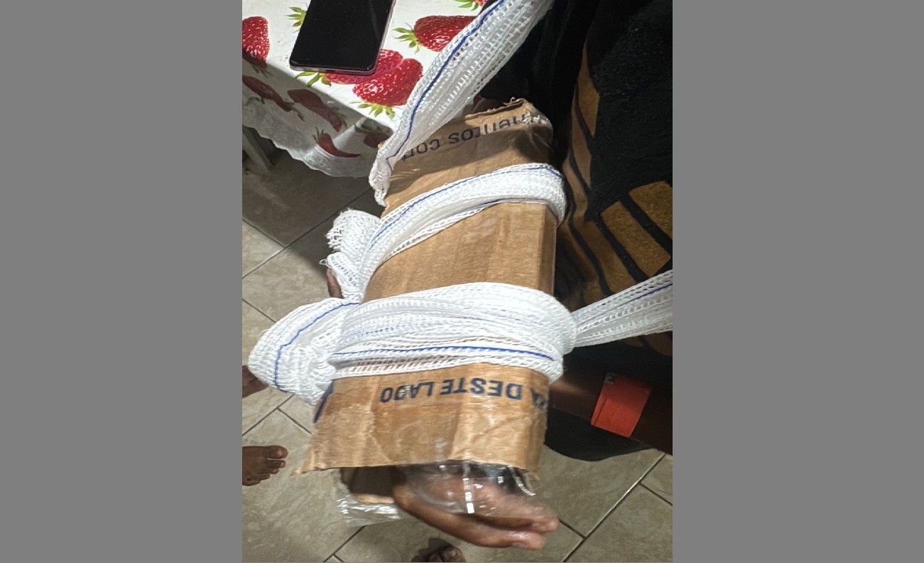 Criança quebra braço e sai da UPA com   imobilização improvisada de papelão em São Pedro da Aldeia