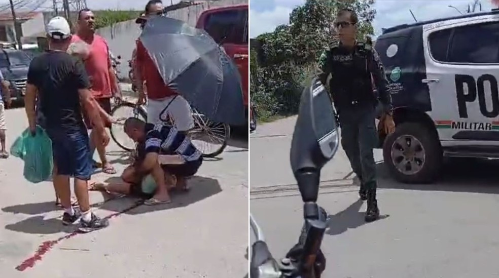 Criança passou por duas cirurgias na perna. A Polícia Militar investiga a ocorrência. — Foto: Reprodução/TV Verdes Mares