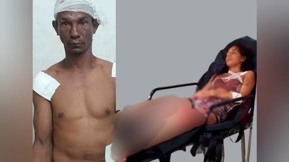 João Mota dos Santos foi agredido por populares após esfaquear a cunhada Larissa da Silva; ambos foram levados ao HMS — Foto: Reprodução / Redes sociais