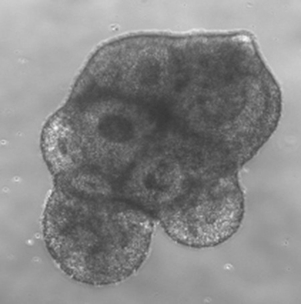 Imagem de microscópio eletrônico mostra um minicérebro. Estrutura simula de forma simples a organização celular encontrada no cérebro humano; — Foto: Reprodução