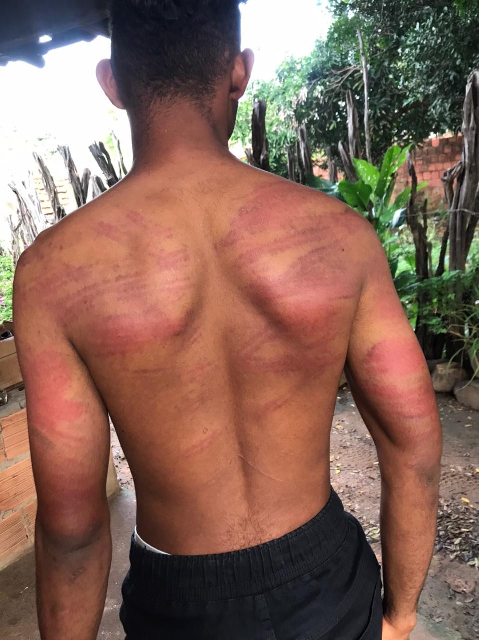 Estudante denuncia policiais militares por tortura em matagal após abordagem em escola no Piauí