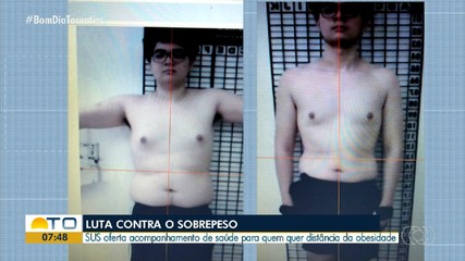Pessoas com obesidade podem fazer acompanhamento pelo SUS