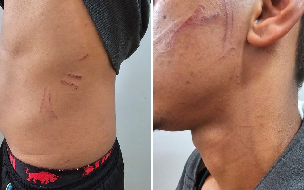 Vítima arranhou namora enquanto era enforcada, em Formosa — Foto: Divulgação/Polícia Civil