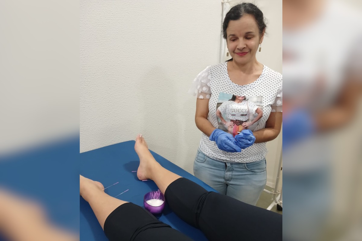 Mulher cega se forma em massoterapia e relata desafio ao aplicar acupuntura: 'Achava que jamais daria conta'