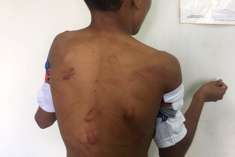 Baixada Santista tem alta nos casos de lesão corporal dolosa