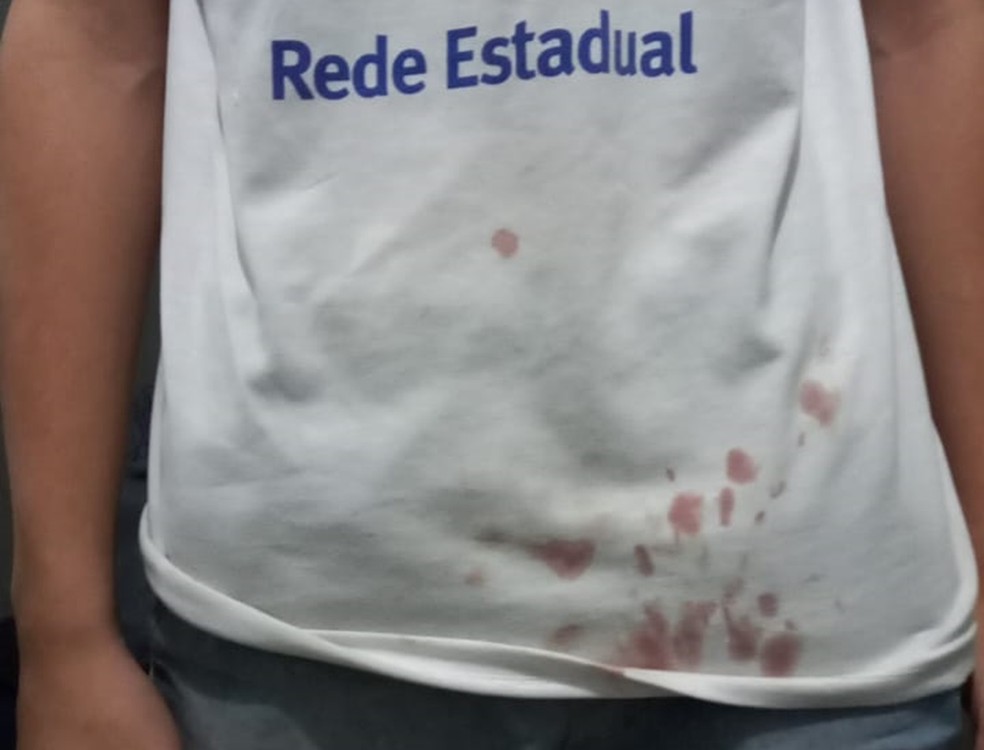 Estudante ficou ferido após colega tentar esfaqueá-lo em escola estadual em Carpina, na Zona da Mata Norte de Pernambuco — Foto: Reprodução/WhatsApp
