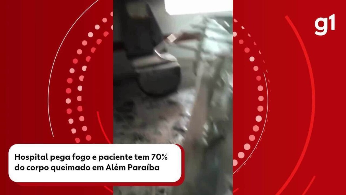 Incêndio em hospital de Além Paraíba deixa paciente com 70% do corpo  queimado