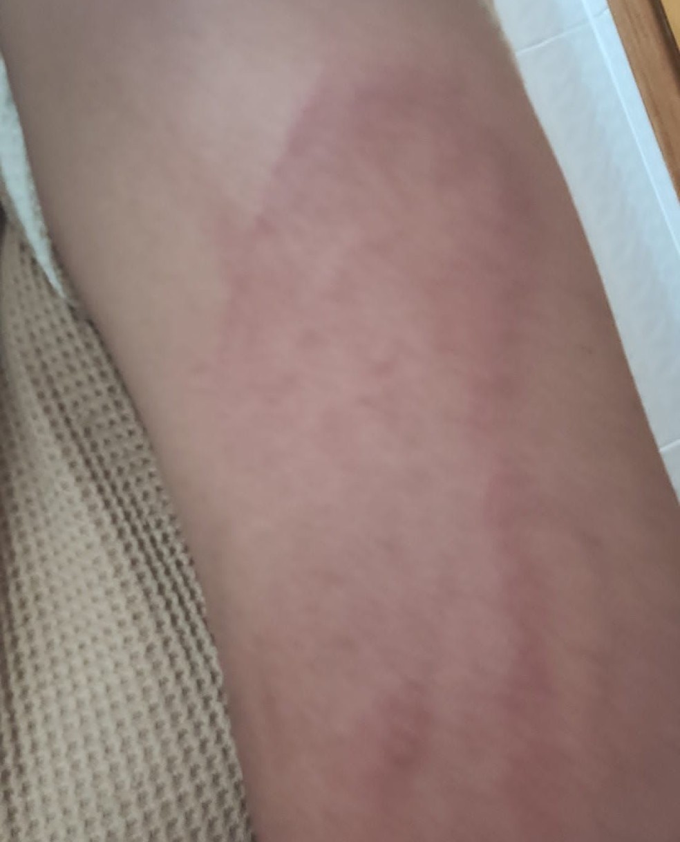 A mulher afirmou que foi agredida pelo pai com o uso de um cinto. — Foto: Reprodução
