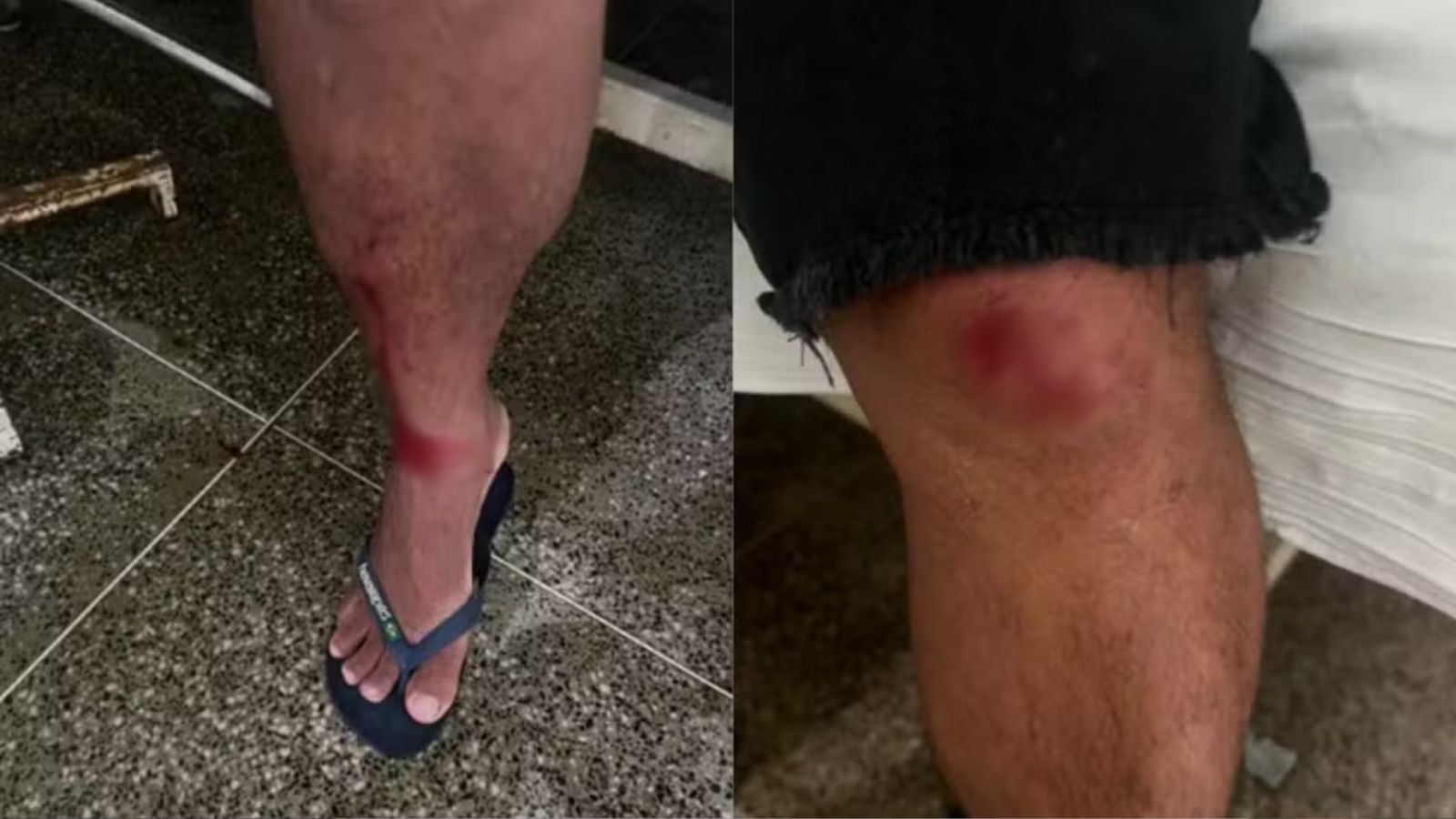 Homem é preso suspeito de agredir tio com golpes de pá após briga por benefício da avó no PI