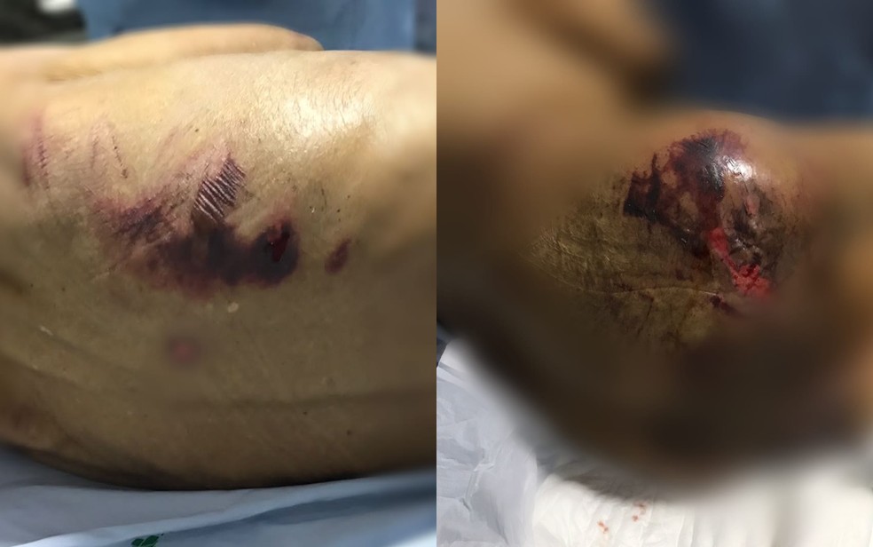 Fotos mostram ferimentos e hematomas em pacientes de clínica clandestina, em Anápolis, Goiás — Foto: Divulgação/DEAI Anápolis