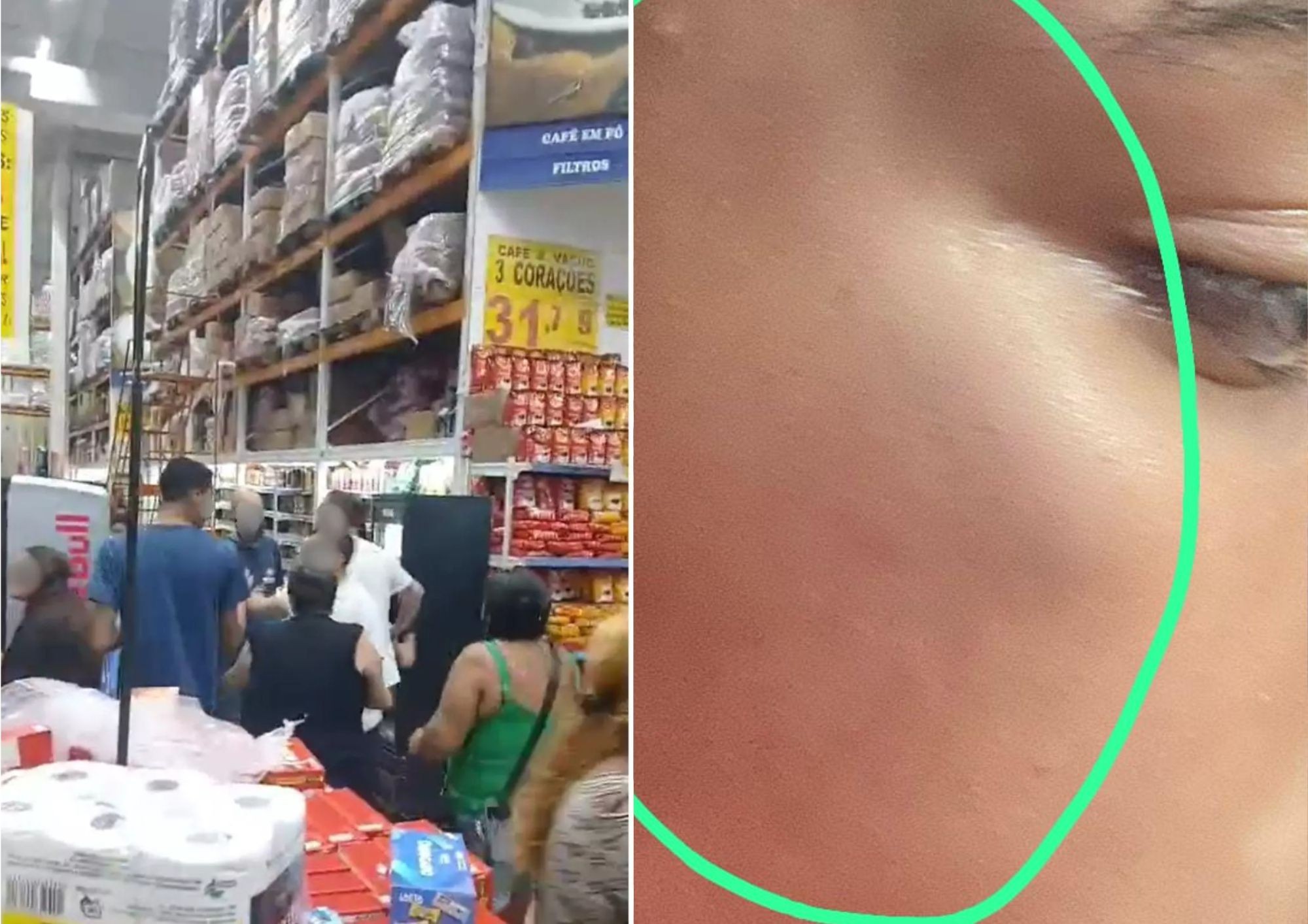 Família pede indenização de R$ 182 mil a mercado após idoso ser chamado de 'aleijado' e ter filhos agredidos
