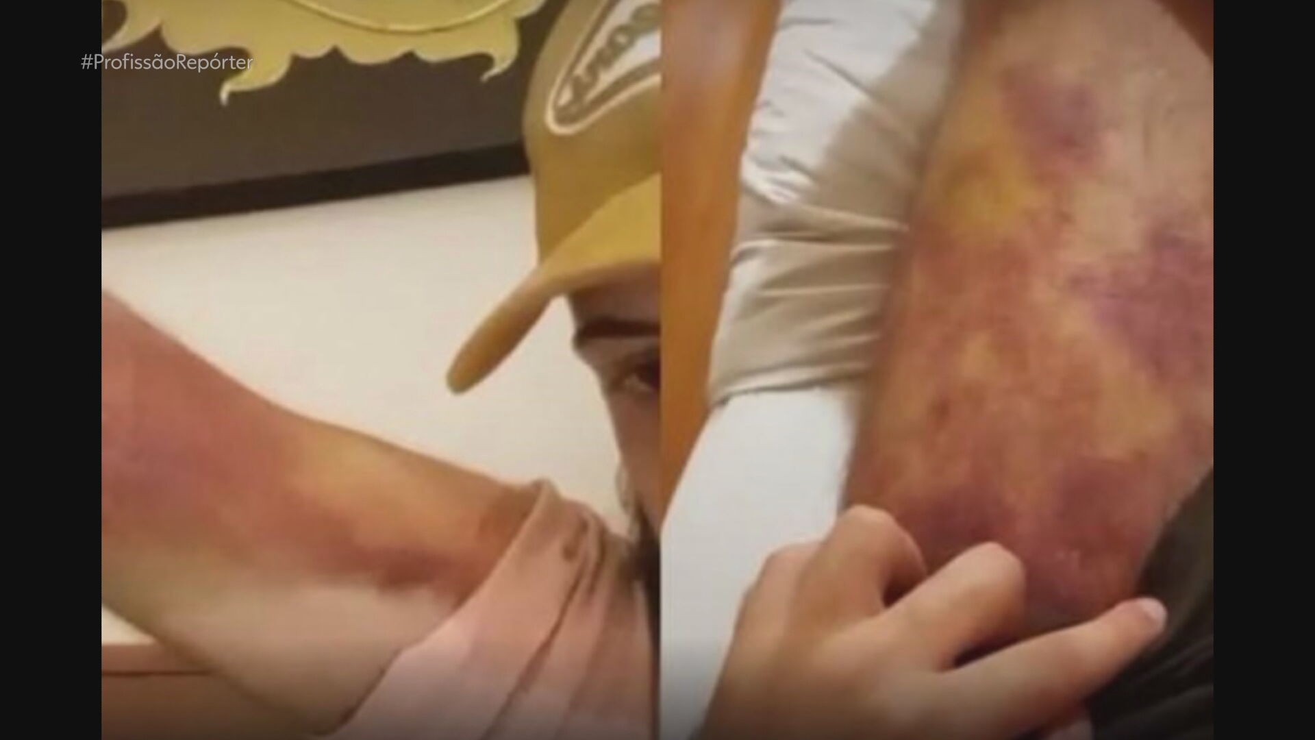 'Se não atinge meta, leva choque': brasileiros relatam drama após serem aliciados por rede internacional de tráfico humano no Sudeste Asiático