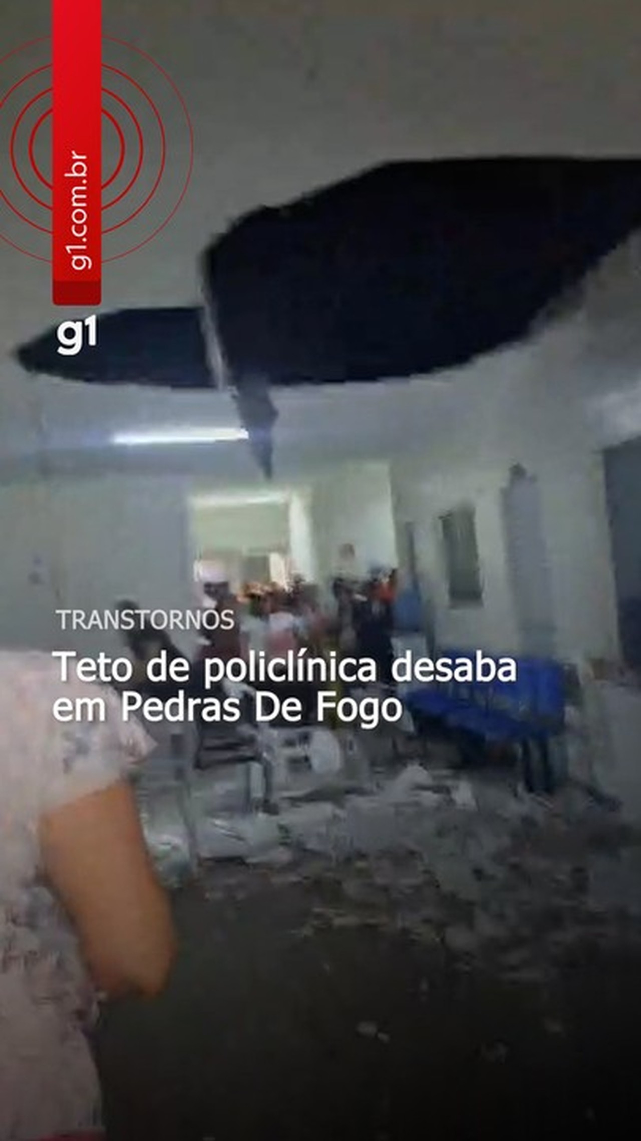 Teto de policlínica desaba em Pedras de Fogo, na Paraíba, e deixa três pessoas feridas