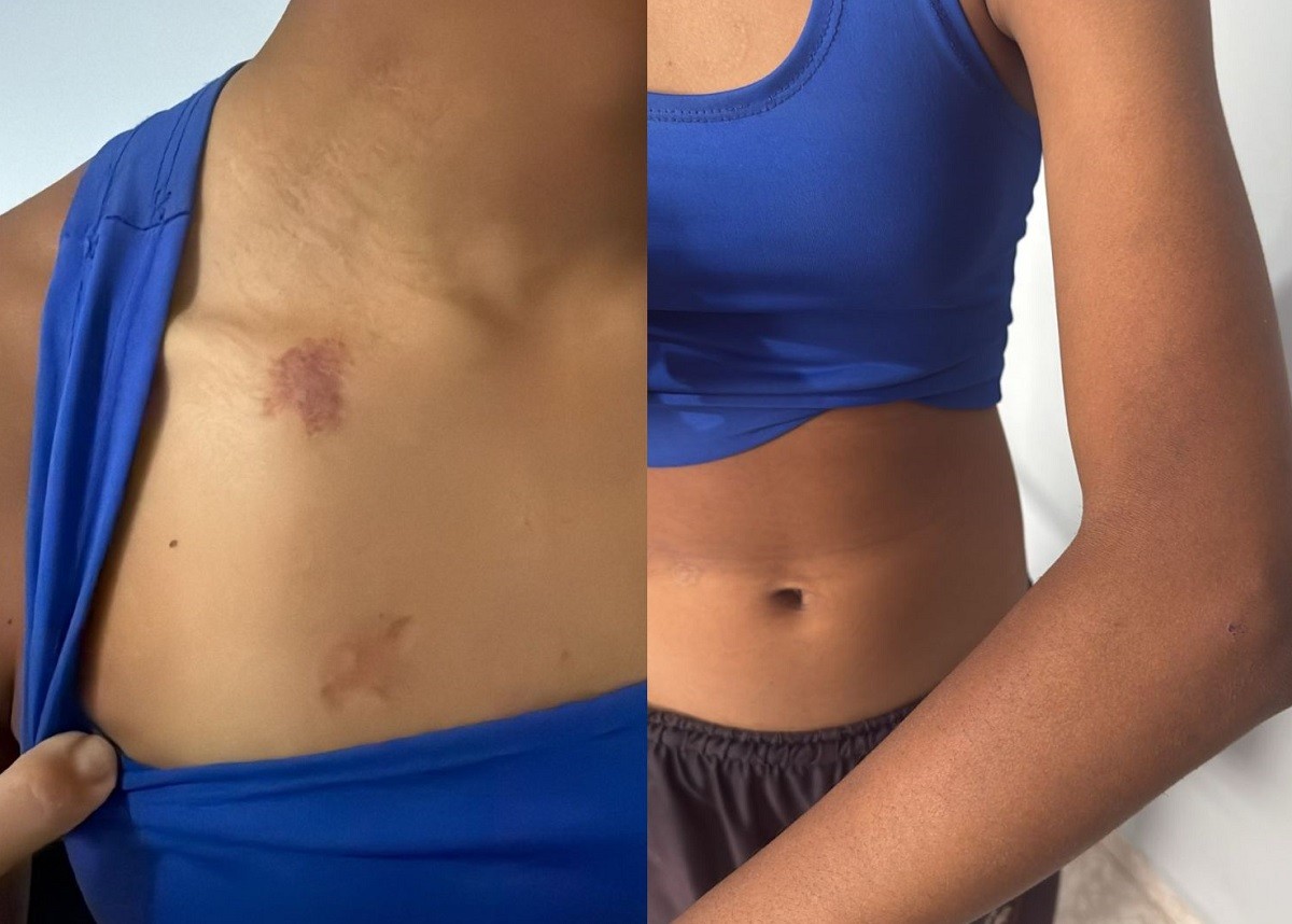 Pai é preso suspeito de agredir filha de 12 anos após ela se recusar a furtar casa de vizinho em Itapuí