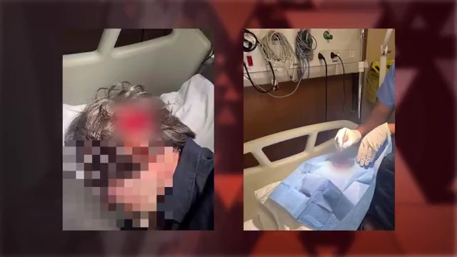 Defesa divulga imagens de ferimentos de homem atingido por garrafa em confusão envolvendo grupo de Ed Motta 