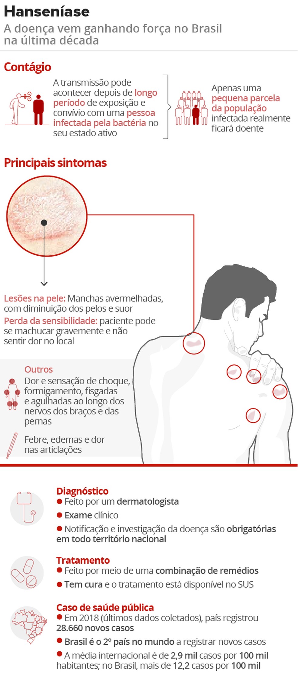 Ministério da Saúde 🩵 on X: Você sabe os sinais e sintomas da Hanseníase?  Aprenda com essa reportagem do #BlogDaSaúde:    / X