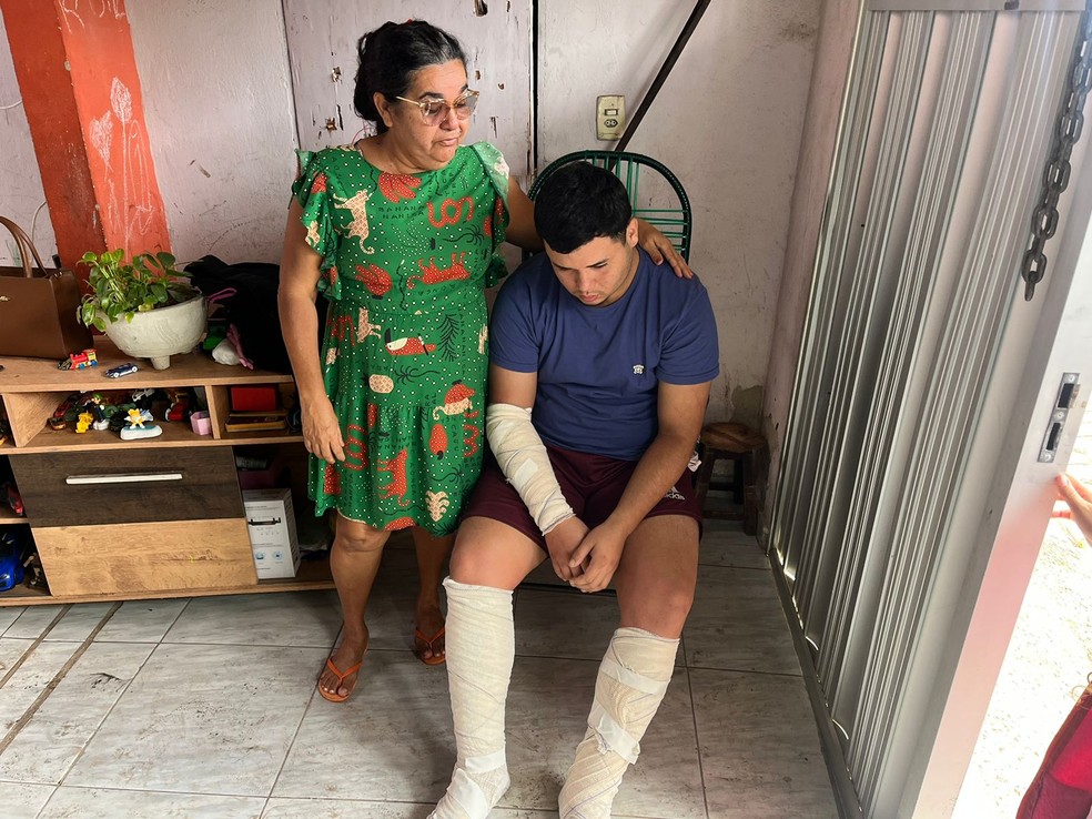 Samuel pereira, de 22 anos, teve queimaduras de primeiro e segundo graus no braço direto e nas duas pernas — Foto: Vinicius Marinho/Inter TV Cabugi