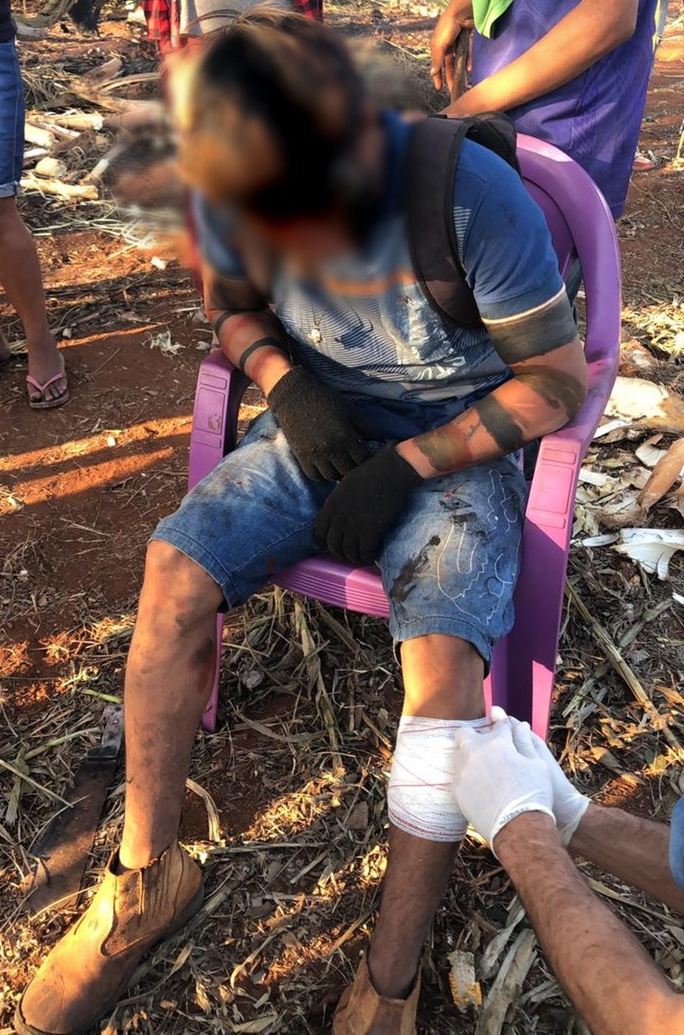 Jovem de 18 anos atingido por bala de borracha. — Foto: Reprodução