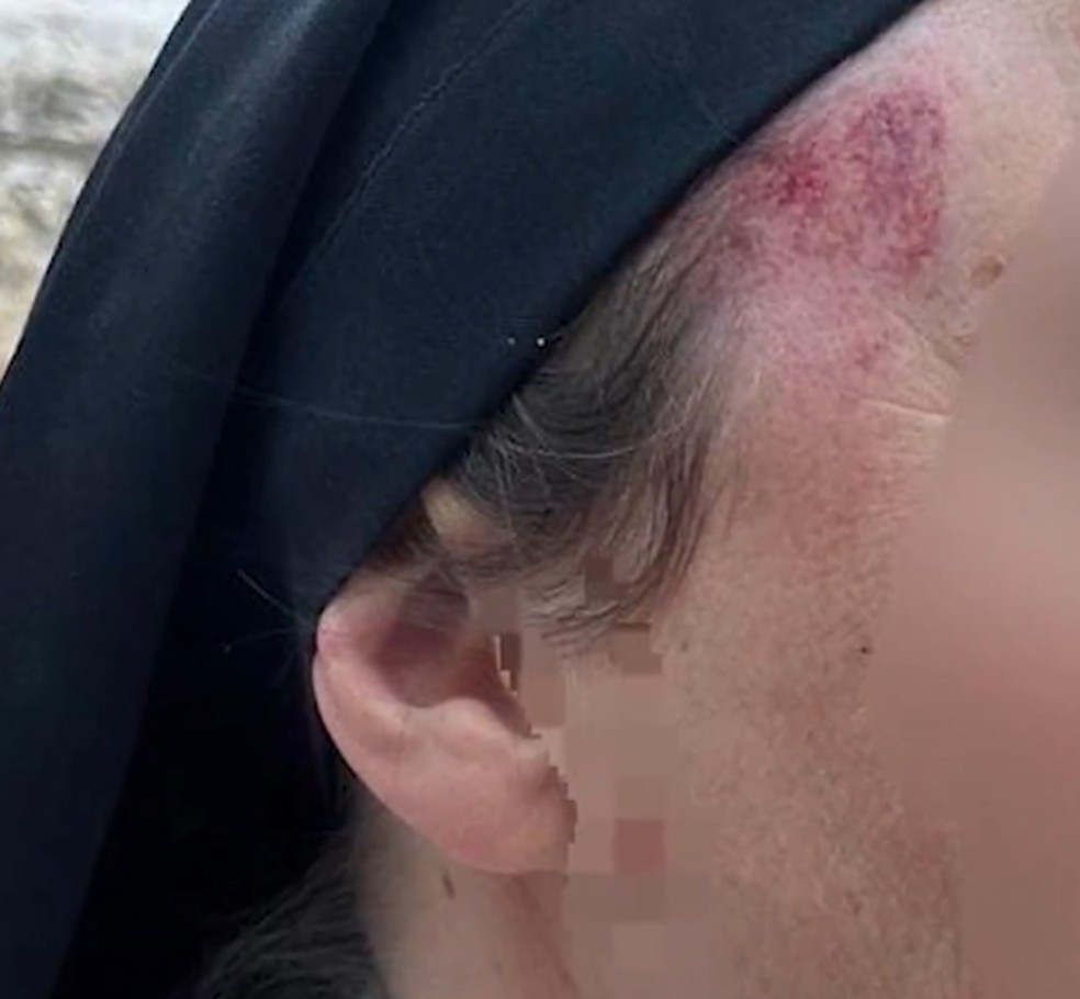 Freira ficou ferida após ser atacada em Jerusalém — Foto: Polícia de Israel
