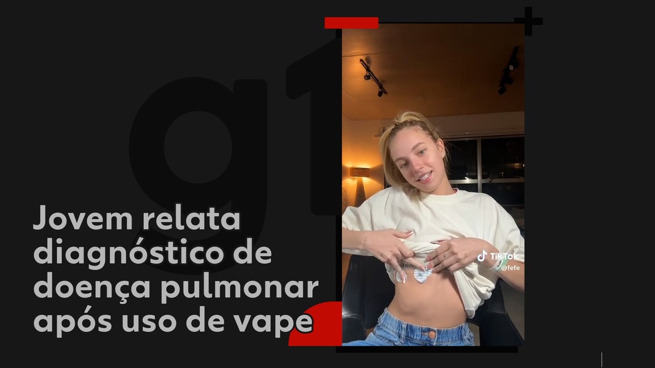 Jovem relata diagnóstico de doença pulmonar após uso de vape
