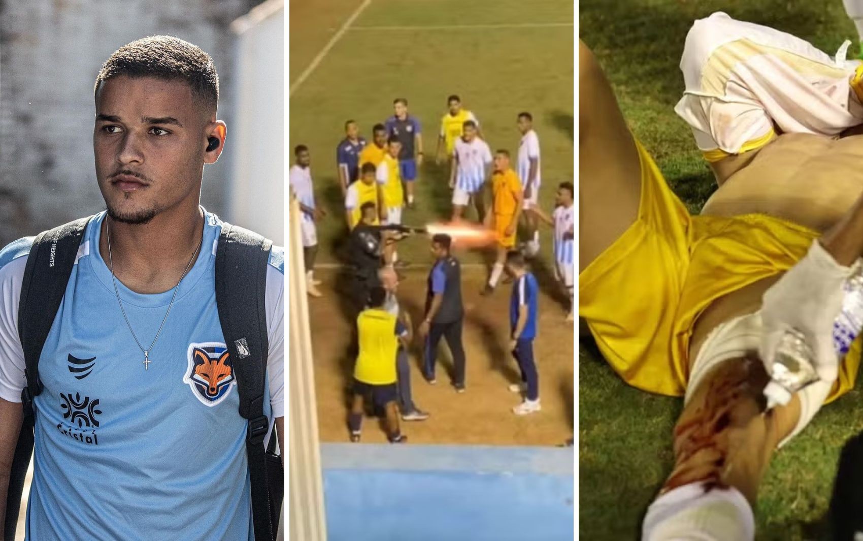 PM afasta policial filmado dando tiro de bala de borracha em goleiro após jogo