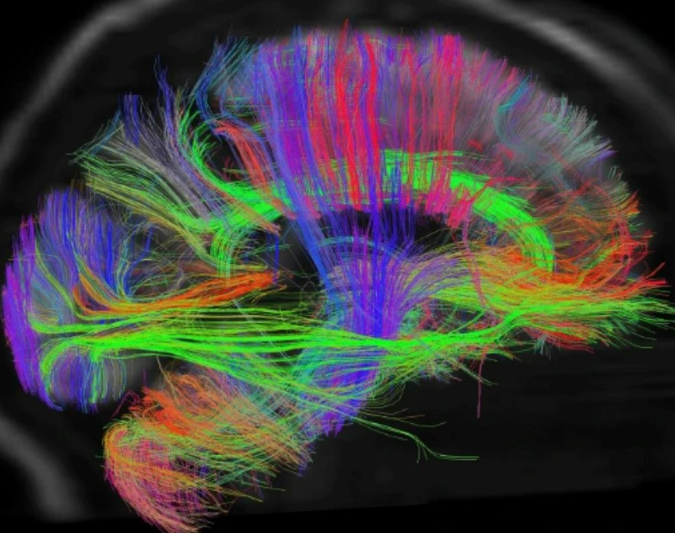 Pesquisadores estão estudando o cérebro na tentativa de compreender melhor a consciência. — Foto: BBC