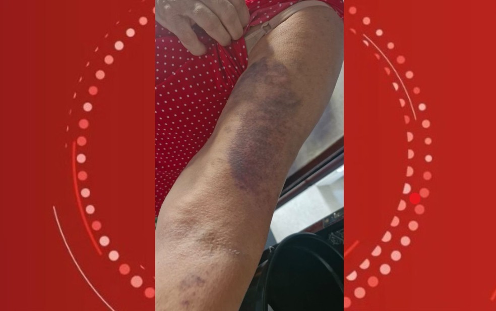 Polícia Civil investiga denúncia de agressão física contra professora de reforço escolar em Salvador — Foto: Arquivo Pessoal