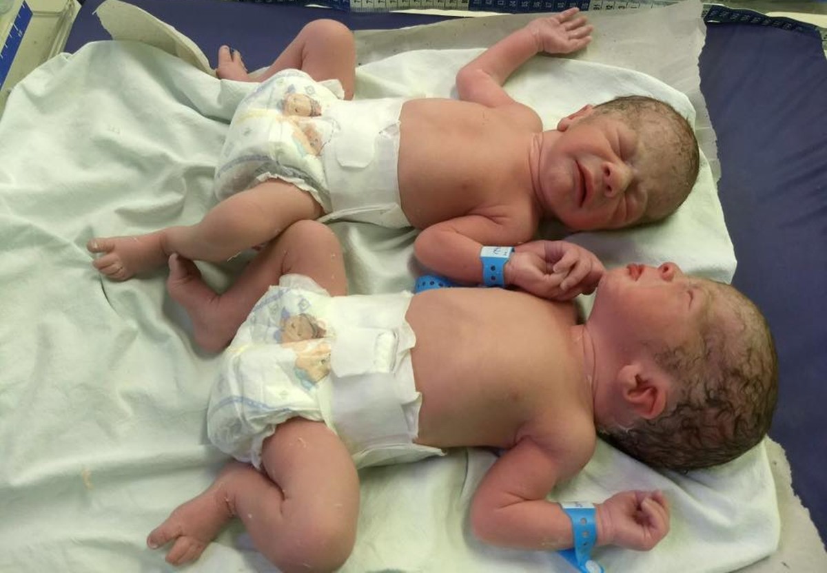 gêmeos ficam de mãos dadas após parto e comovem equipe médica no sertão