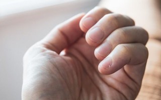 Como as unhas alertam sobre saúde e ajudam a detectar doenças