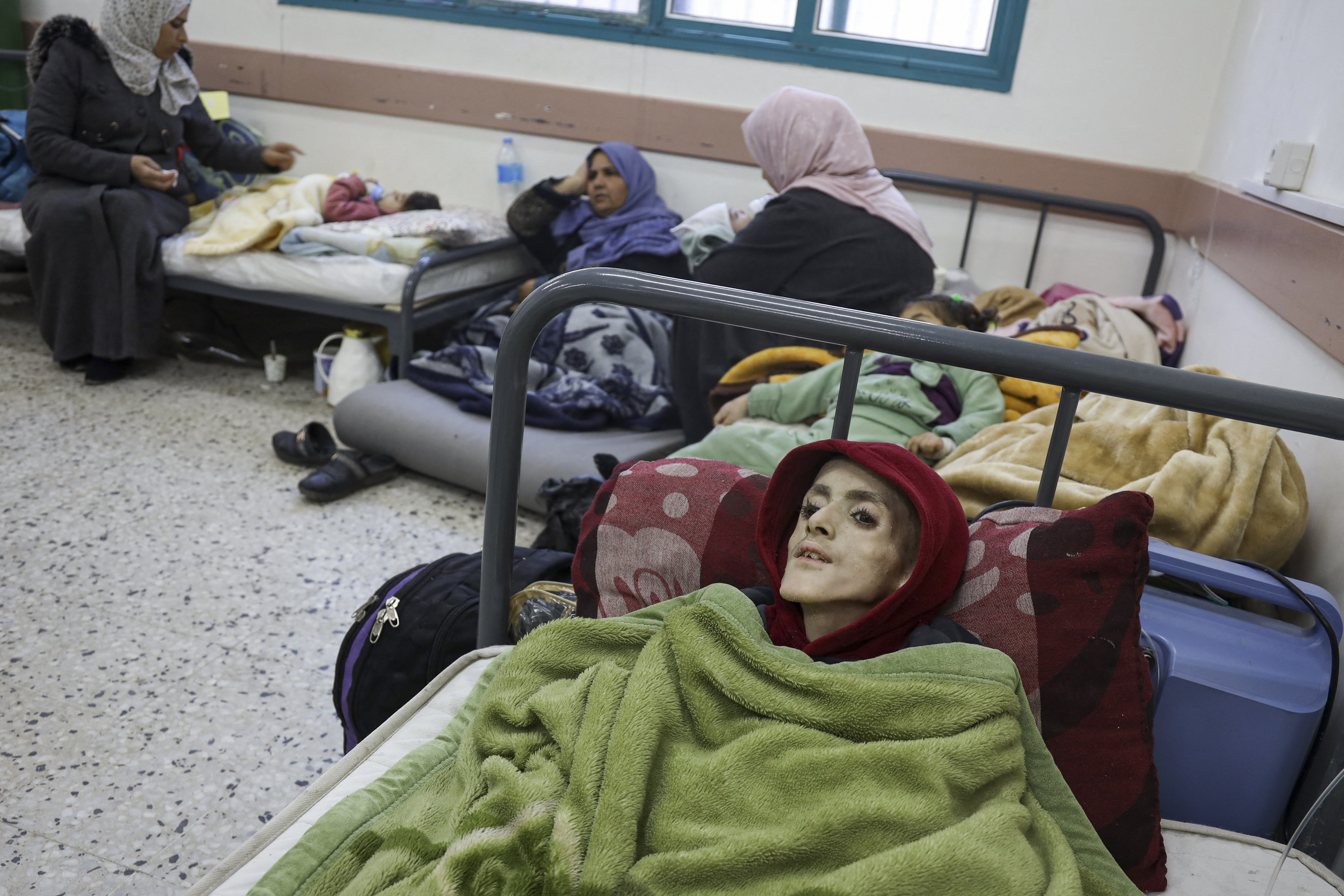 Menino palestino morre com desnutrição grave e em meio a falta de remédios em Gaza