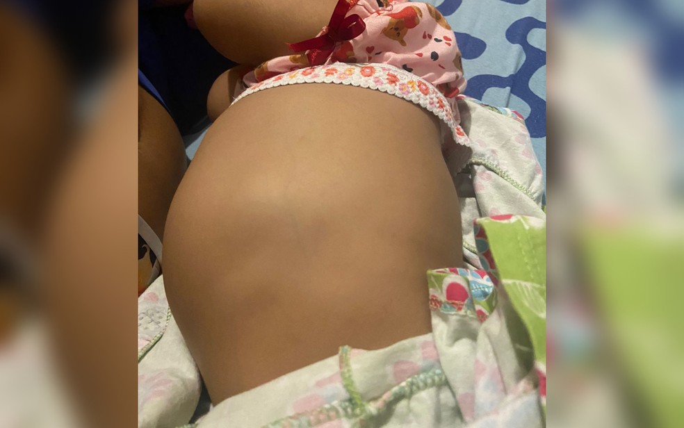 Rebeca Emanuelly Rodrigues de Sousa espera por uma transferência para tratamento de um possível tumor na barriga — Foto: Acervo pessoal/Cleidielle Rodrigues de Sousa