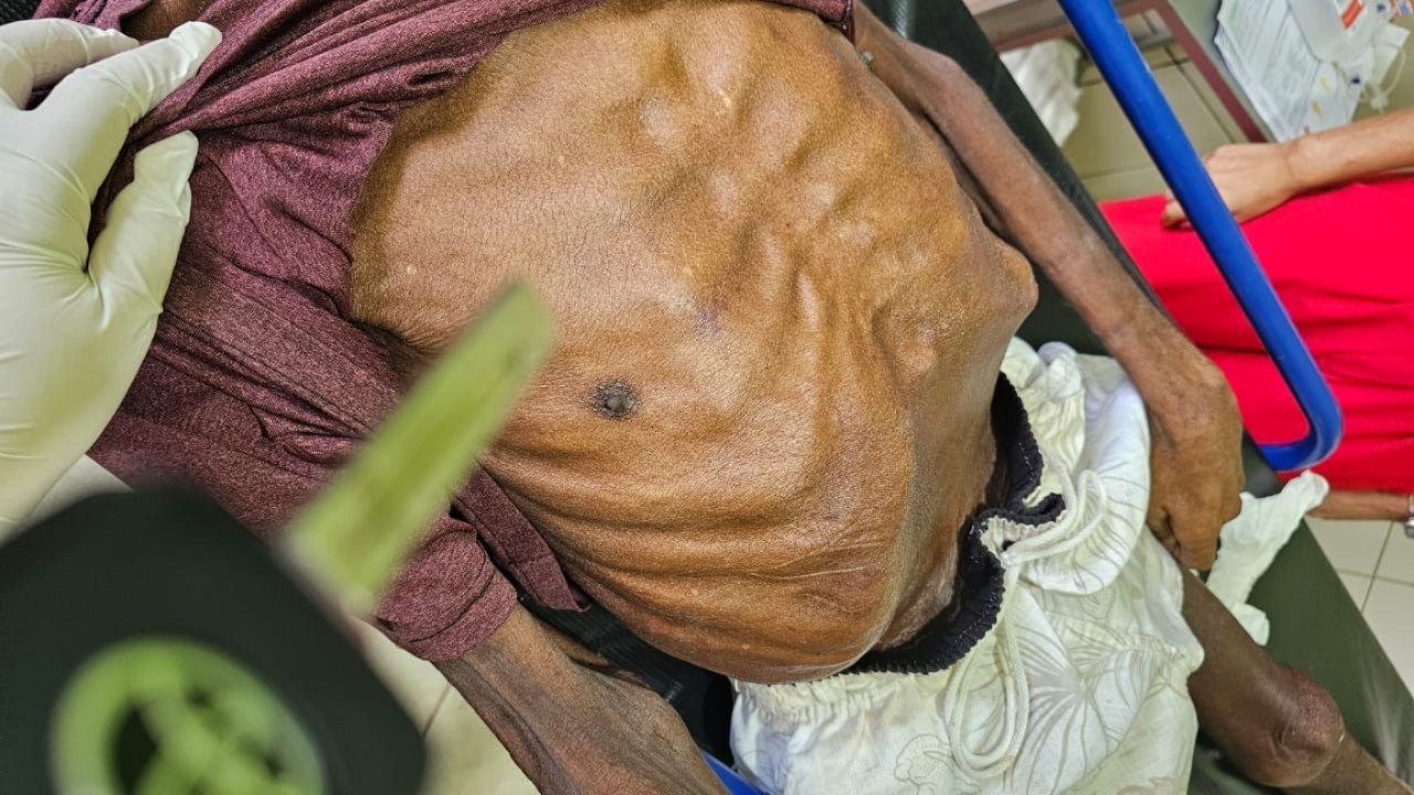Filha é presa suspeita de maus-tratos após morte do pai com sinais de violência e desnutrição no PA