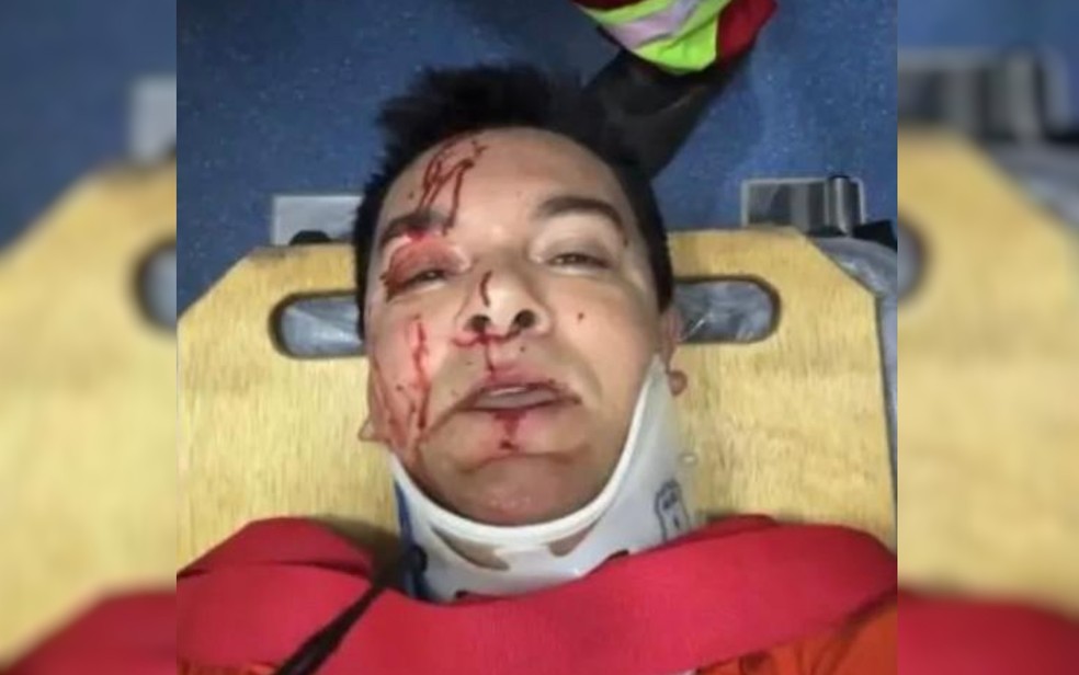 Cantor Regis Danese após sofrer acidente em Goiás — Foto: Reprodução/Redes Sociais