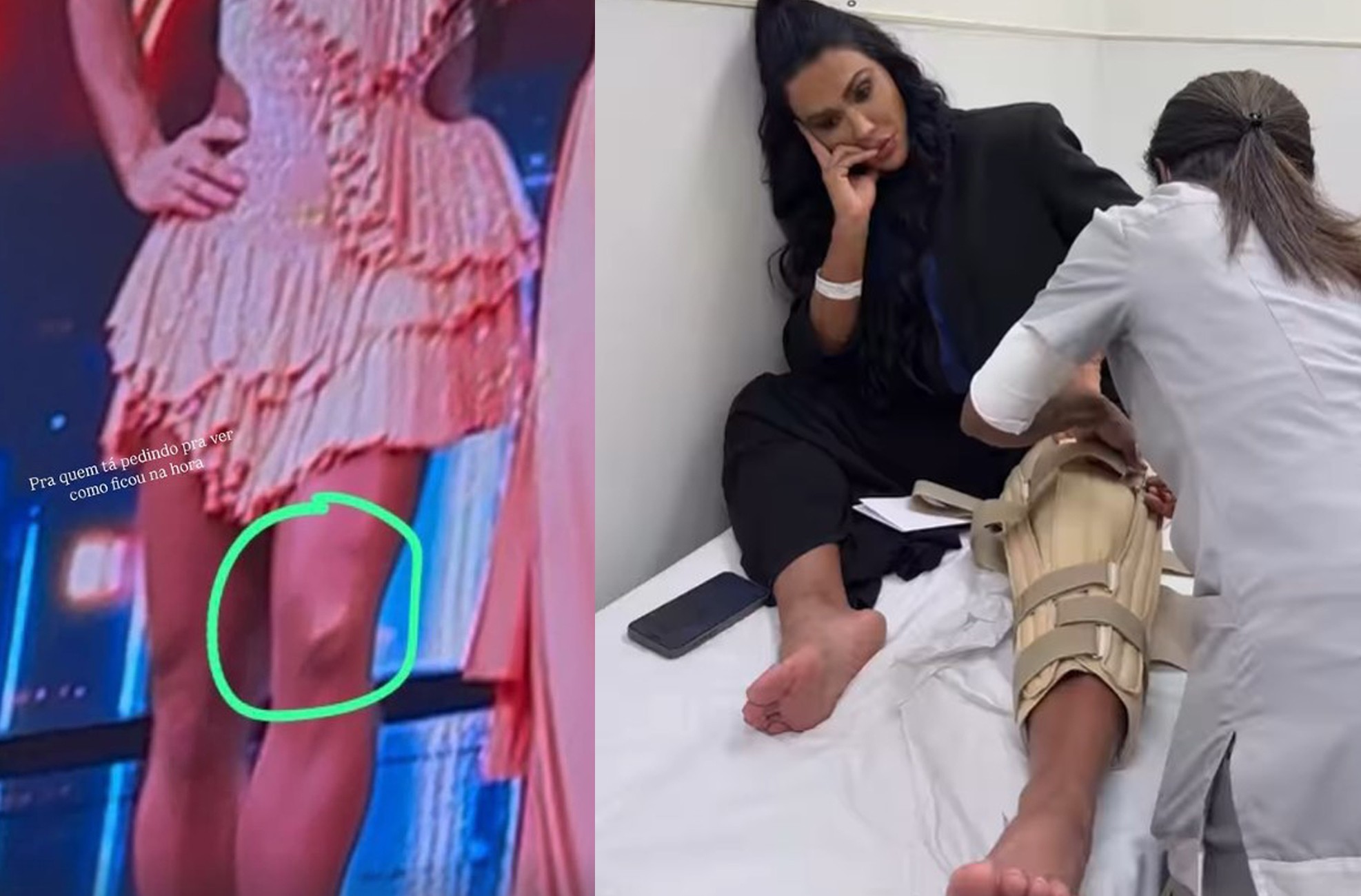 Gracyanne Barbosa fala sobre pausa após lesão no joelho: 'Hoje começo a dança da recuperação'