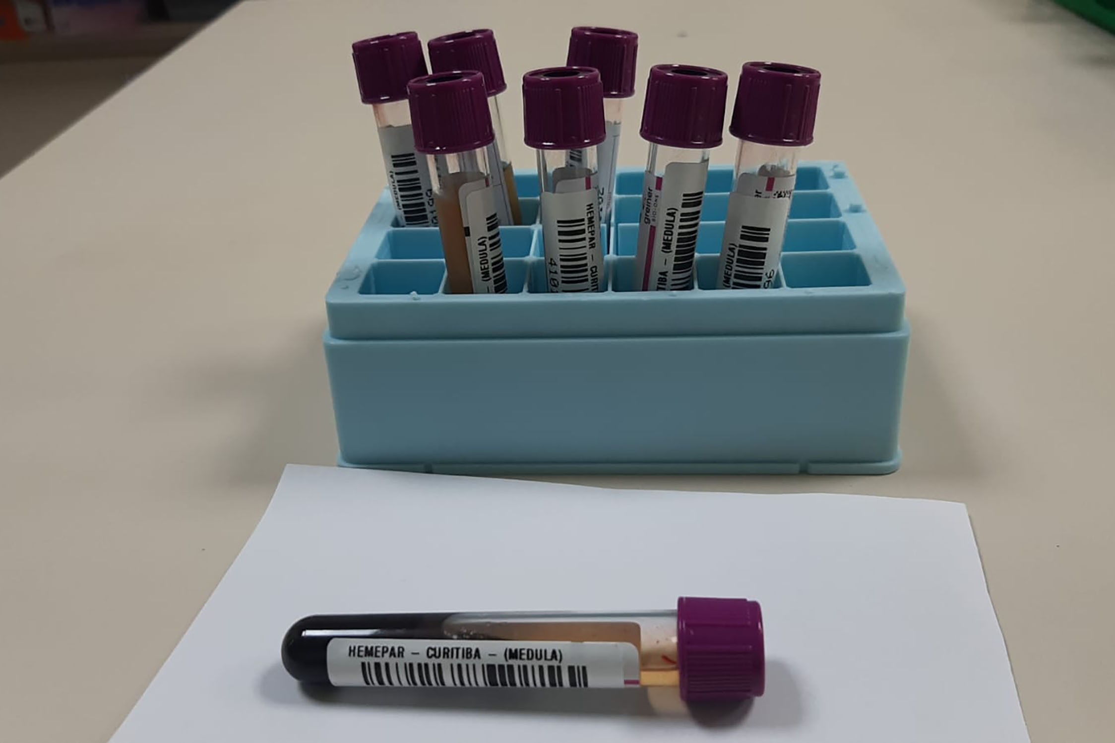 Com quase 600 na fila, DF não faz transplante de medula na rede pública e obriga pacientes a viajar