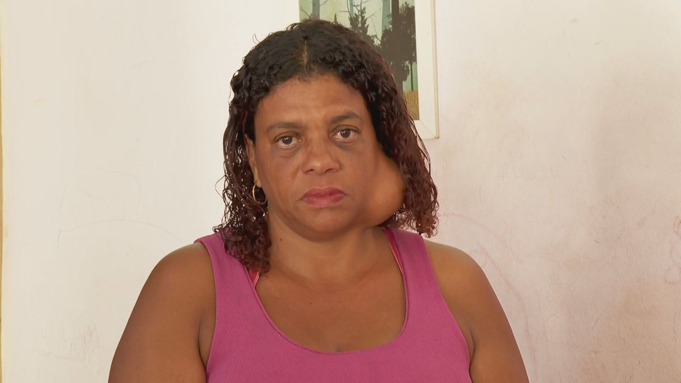A catadora de recicláveis Denize Campos espera por uma cirurgia de retirada de tumor há 16 anos — Foto: Reprodução/ TV Globo