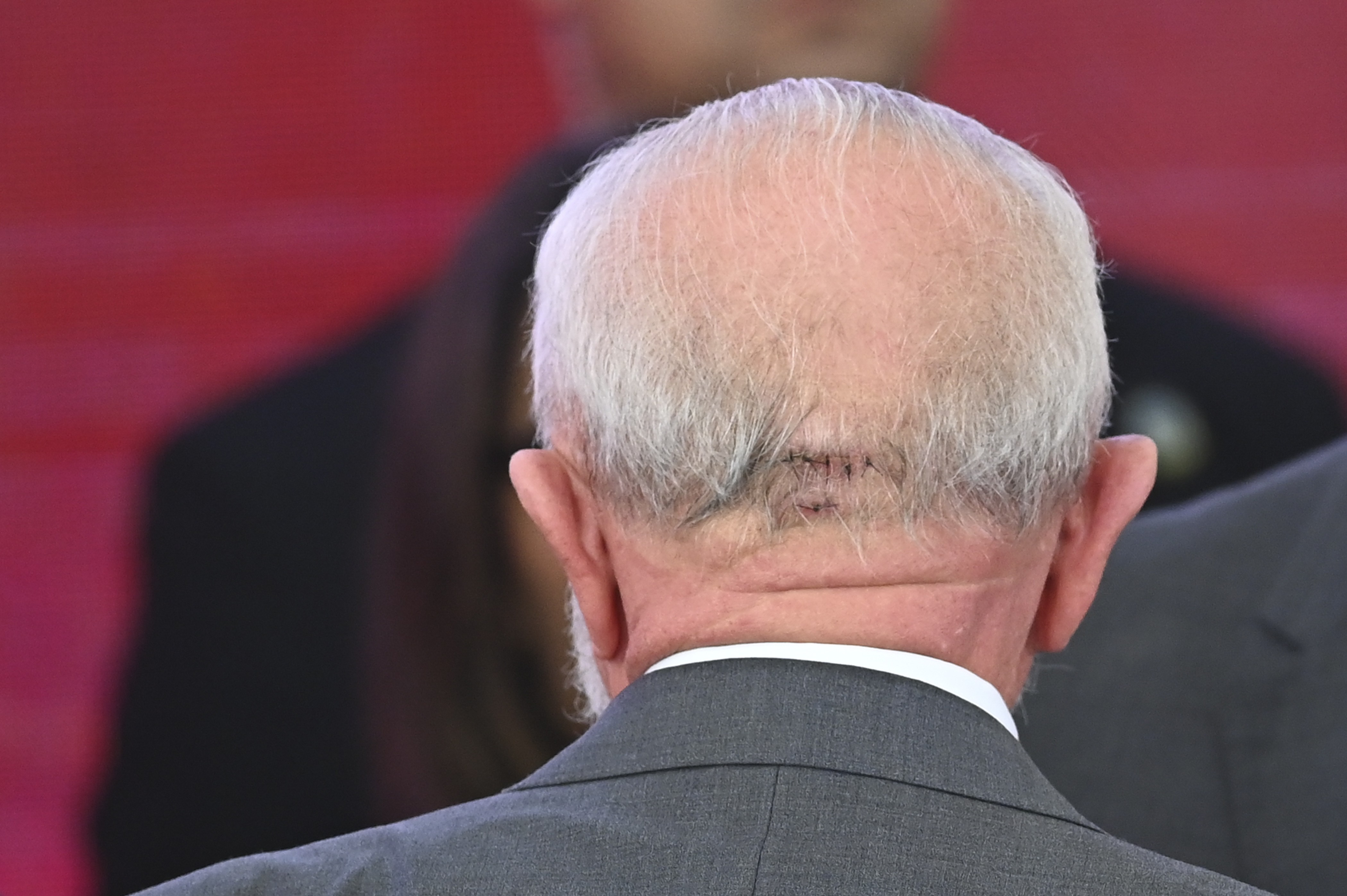 Lula volta a hospital para exames duas semanas após queda, e permanece 'sem sintomas' | Política | G1